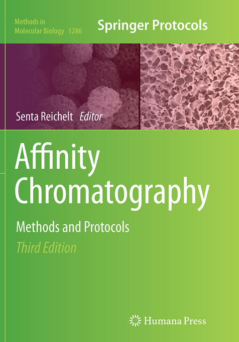 Affinity Chromatography - 