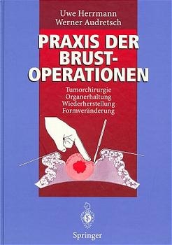 Praxis der Brustoperationen - Uwe Herrmann, Werner Audretsch