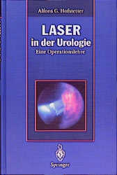 Laser in der Urologie - 