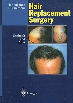 Hair Replacement Surgery - Pierre Bouhanna, Jean C. Dardour