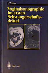 Vaginalsonographie im ersten Schwangerschaftsdrittel - Josef Wisser