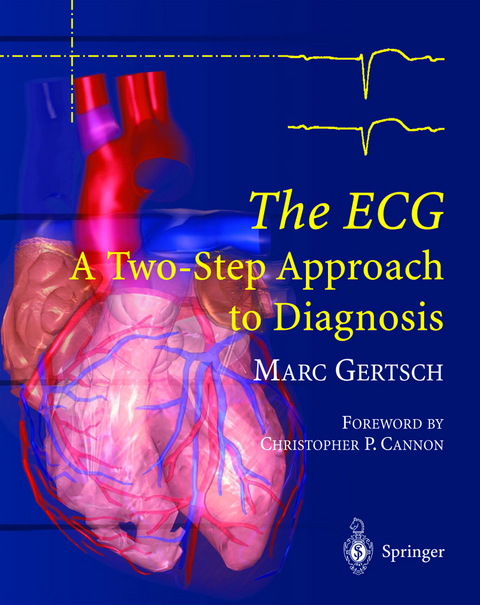 The ECG - Marc Gertsch