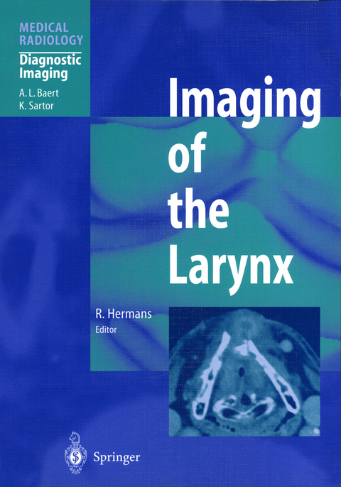 Imaging of the Larynx - 