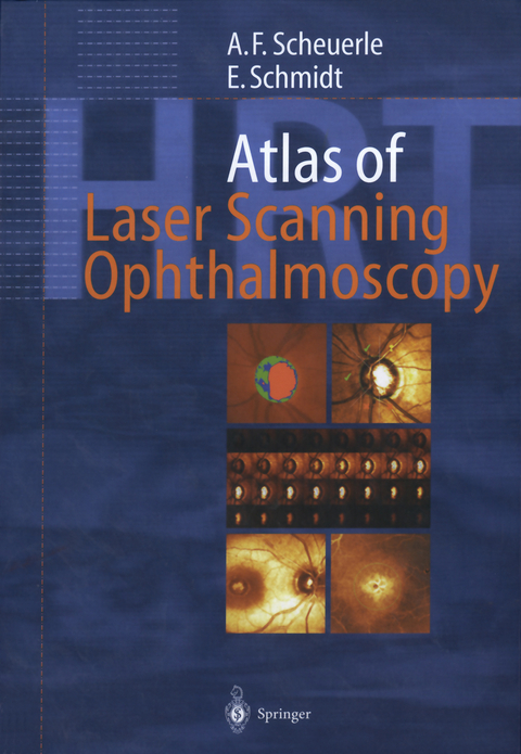 Atlas of Laser Scanning Ophthalmoscopy - Alexander Friedrich Scheuerle, Eckart Schmidt