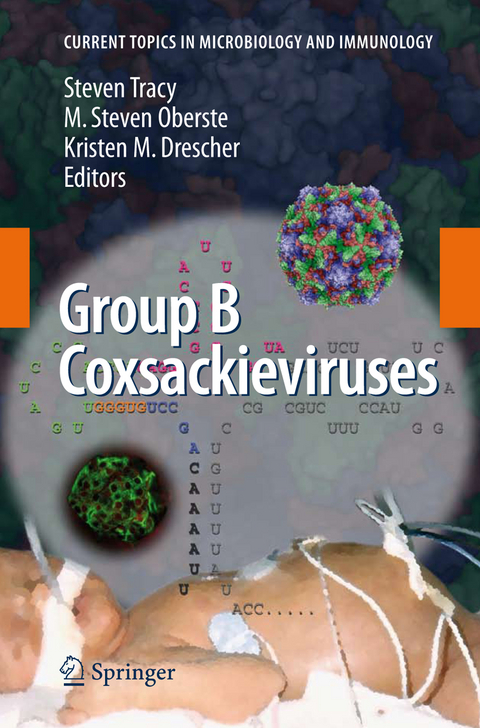 Group B Coxsackieviruses - 