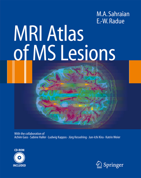 MRI Atlas of MS Lesions - M.A. Sahraian, Ernst-Wilhelm Radü