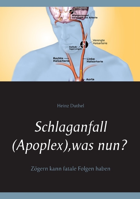 Schlaganfall (Apoplex), was nun? - Heinz Duthel
