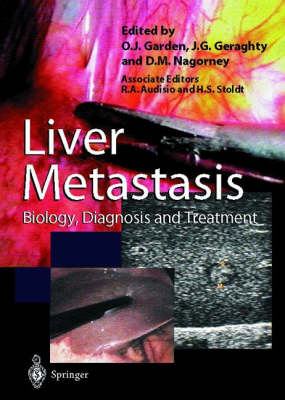 Liver Metastases - 