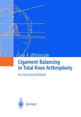 Ligament Balancing in Total Knee Arthroplasty - Leo A. Whiteside