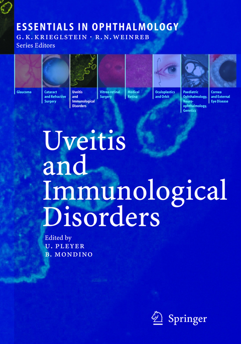 Uveitis and Immunological Disorders - 