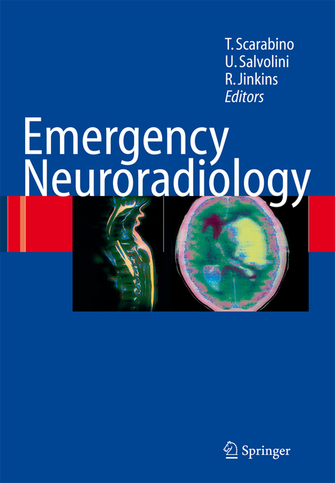 Emergency Neuroradiology - 
