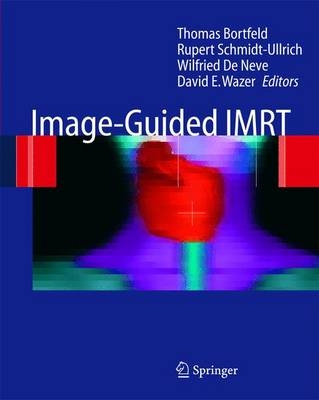 Image-Guided IMRT - 