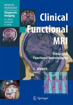 Clinical Functional MRI - 