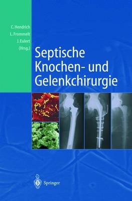 Septische Knochen- und Gelenkchirurgie - 