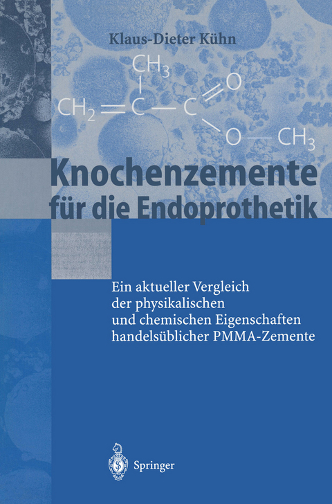 Knochenzemente für die Endoprothetik - K.-D. Kühn