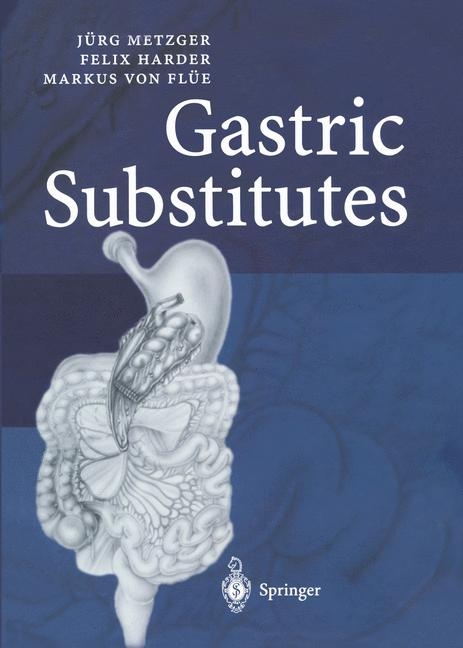 Gastric Substitutes - Jürg Metzger, Felix Harder, Markus von Flüe