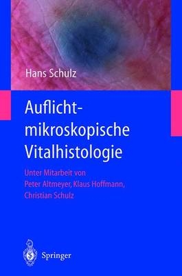 Auflichtmikroskopische Vitalhistologie - Hans Schulz