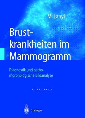 Brustkrankheiten im Mammogramm - Marton Lanyi