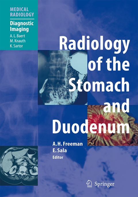 Radiology of the Stomach and Duodenum - 