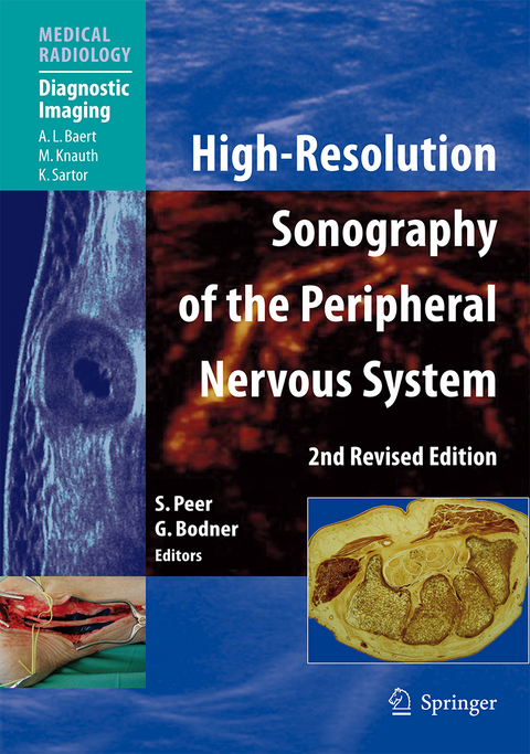 High-Resolution Sonography of the Peripheral Nervous System - 