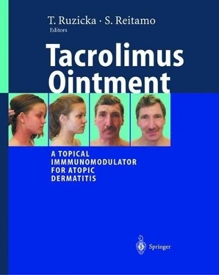 Tacrolimus Ointment - 