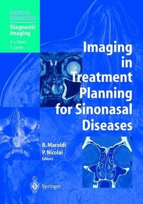 Imaging in Treatment Planning for Sinonasal Diseases - 