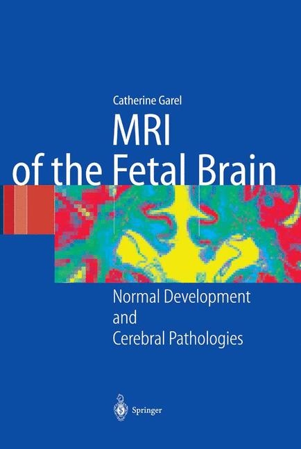 MRI of the Fetal Brain - C. Garel
