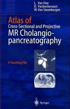 Atlas of Cross-Sectional and Projective MR Cholangiopancreatography - L. van Hoe, D. Vanbeckevoort, W. van Steenbergen