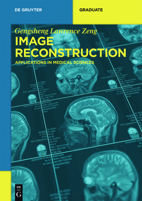 Image Reconstruction - Gengsheng Lawrence Zeng