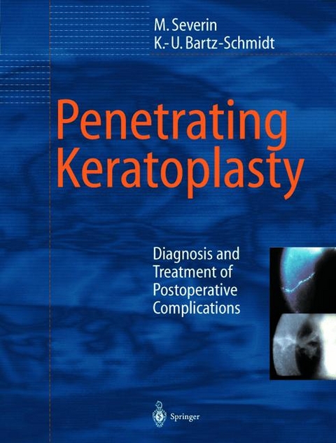 Penetrating Keratoplasty - Maria Severin, Karl U. Bartz-Schmidt