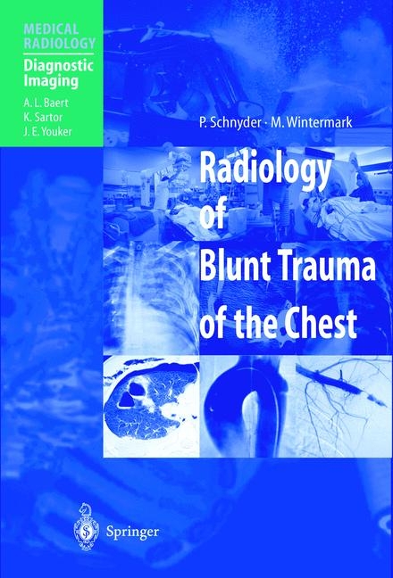 Radiology of Blunt Trauma of the Chest - P. Schnyder, M. Wintermark