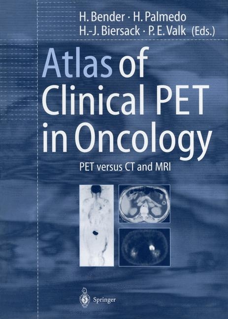 Atlas of the clinical PET in Oncology - 