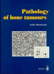 Pathology of bone tumours - Andre Mazabraud