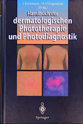 Handbuch der dermatologischen Phototherapie und Photodiagnostik - 