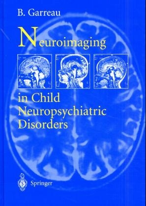 Neuroimaging in Child Neuropsychiatric Disorders - 