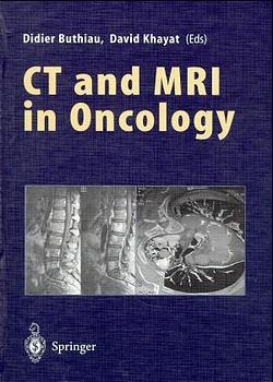 CT and MRI in Oncology