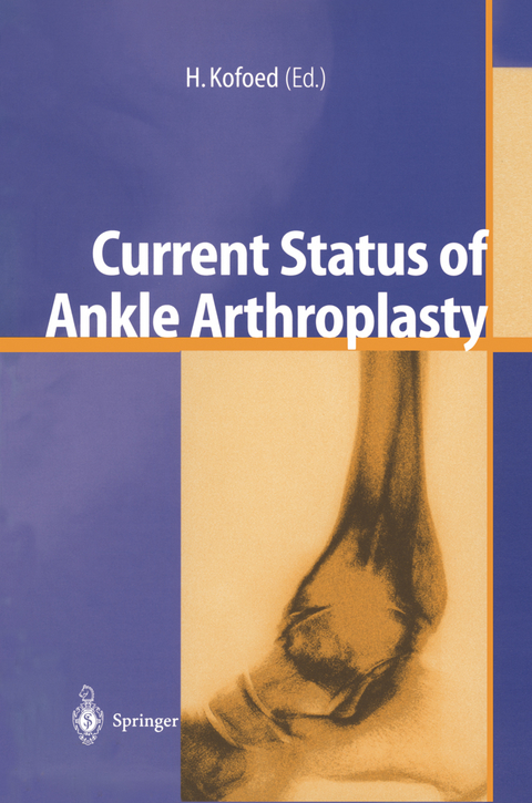 Current Status of Ankle Arthroplasty - 