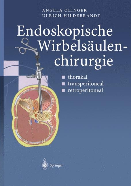 Endoskopische Wirbelsäulenchirurgie - Angela Olinger, Ulrich Hildebrandt