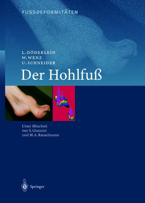 Fussdeformitäten - L. Döderlein, W. Wenz, U. Schneider