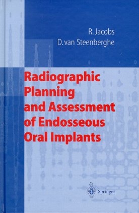 Endosseous Oral Implants - Reinhilde Jacobs, Daniel van Steenberghe