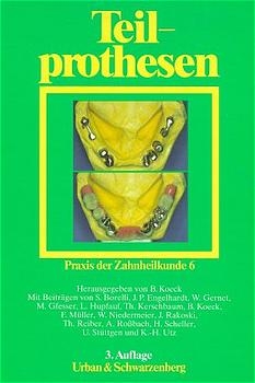 Praxis der Zahnheilkunde - PdZ. Strukturiert nach dem PermaNova-Verfahren / Teilprothesen - 