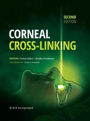 Corneal Cross-Linking, Second Edition - 