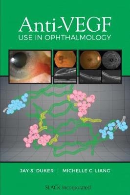 Anti-VEGF Use in Ophthalmology - 