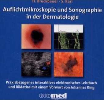 Auflichtmikroskopie und Sonographie in der Dermatologie - Harald Bruckbauer, Sonja Karl