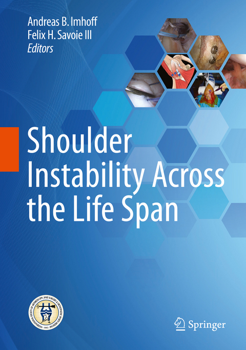 Shoulder Instability Across the Life Span - 