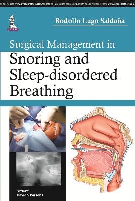 Surgical Management in Snoring and Sleep-disordered Breathing - Rodolfo Lugo Saldana