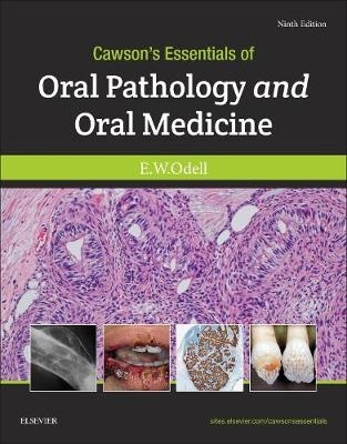 Cawson's Essentials of Oral Pathology and Oral Medicine E-Book -  Edward W Odell
