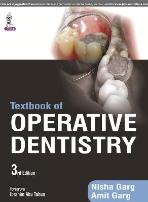 Textbook of Operative Dentistry - Nisha Garg, Amiit Garg