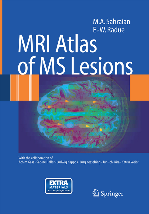 MRI Atlas of MS Lesions - M.A. Sahraian, Ernst-Wilhelm Radü