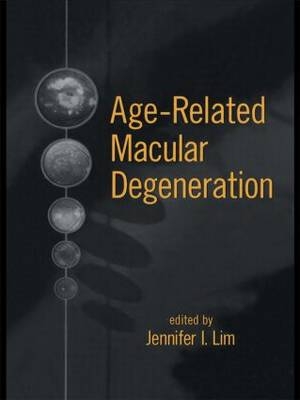 Age-Related Macular Degeneration - 